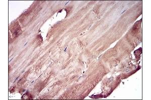 Immunohistochemical analysis of paraffin-embedded human muscle tissues using PRL mouse mAb with DAB staining. (Prolactin 抗体  (AA 65-173))