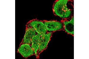 Immunofluorescence analysis of SMMC-7721 cells using GRM7 mouse mAb (green).