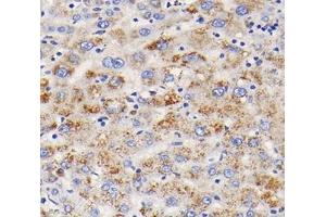 Immunohistochemistry analysis of paraffin-embedded human liver using,TFR2 (ABIN7075965) at dilution of 1: 400 (Transferrin Receptor 2 抗体)
