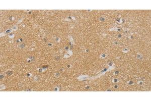 Immunohistochemistry of paraffin-embedded Human brain using NDRG1 Polyclonal Antibody at dilution of 1:70 (NDRG1 抗体)