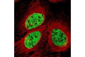 Immunofluorescence staining of U-2 OS cell with antibody shows specific staining in the nucleoplasm in green. (SMCHD1 抗体)