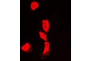 Immunofluorescent analysis of Histone Deacetylase 6 staining in Jurkat cells.