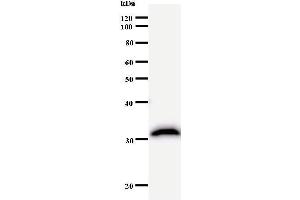 Western Blotting (WB) image for anti-CREB Binding Protein (CREBBP) antibody (ABIN932995) (CBP 抗体)
