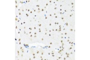 Immunohistochemistry of paraffin-embedded mouse brain using SET antibody at dilution of 1:100 (x40 lens). (SET/TAF-I 抗体)