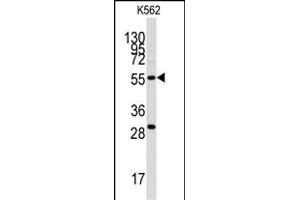 Western blot analysis of anti-CLIC5 Antibody (ABIN391843 and ABIN2841681) in K562 cell line lysates (35 μg/lane). (CLIC5 抗体)