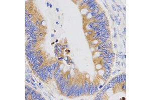 Immunohistochemistry (IHC) image for anti-Pepsinogen C (PGC) (AA 100-200) antibody (ABIN6219816) (PGC 抗体  (AA 100-200))