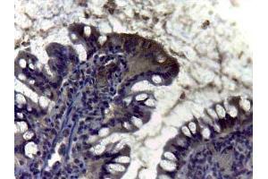 Immunohistochemistry of Rabbit anti Carbonic Anhydrase II antibody Tissue: intestine Staining: diffuse positivity of enzyma Carbonic Anidrase II in brush border of villus (CA2 抗体)