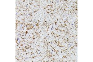 Immunohistochemistry of paraffin-embedded human brain using CLN8 antibody (ABIN7266285) at dilution of 1:300 (40x lens). (CLN8 抗体)