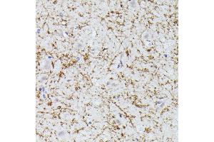 Immunohistochemistry of paraffin-embedded human brain using CLN8 antibody (ABIN7266285) at dilution of 1:300 (40x lens). (CLN8 抗体)
