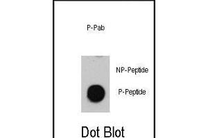Dot blot analysis of anti-Phospho-ATM-p Antibody (ABIN389888 and ABIN2839734) on nitrocellulose membrane.