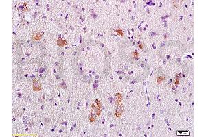 Formalin-fixed and paraffin embedded rat brain tissue labeled with Anti-APC/Adenomatous Polyposis Coli Polyclonal Antibody, Unconjugated (ABIN702550) at 1:200 followed by conjugation to the secondary antibody, (SP-0023), and DAB staining (APC 抗体  (AA 2751-2843))