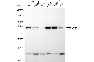 Western blotting analysis using zyxin antibody (ABIN7800906). (Recombinant ZYX 抗体)