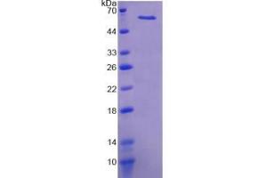 SDS-PAGE (SDS) image for Kininogen (High Molecular Weight) (AA 268-540) protein (His tag,SUMO Tag) (ABIN3209914)