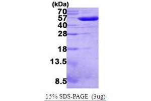GOR (AA 1-450) (Active) protein (His tag)