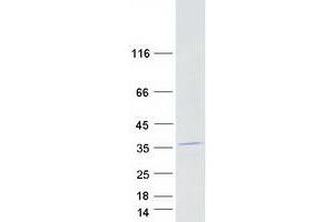 Western Blotting (WB) image for Carbonic Anhydrase I (CA1) (Transcript Variant 2) protein (Myc-DYKDDDDK Tag) (ABIN2713120)
