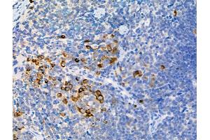ABIN6255252 and ABIN6267093 at 1/100 staining Mouse spleen tissue by IHC-P. (ATG13 抗体  (pSer355))