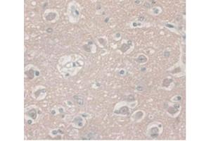 IHC-P analysis of Human Brain Tissue, with DAB staining. (ENO2/NSE 抗体  (AA 2-285))
