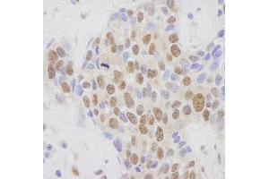 anti-Mediator Complex Subunit 1 (MED1) (C-Term) antibody