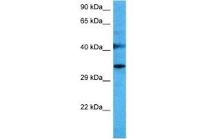 Western Blotting (WB) image for anti-Sprouty Homolog 1, Antagonist of FGF Signaling (SPRY1) (N-Term) antibody (ABIN2784216)