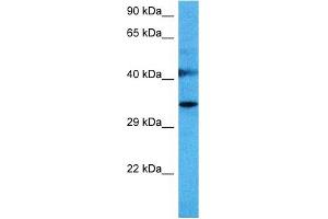 Host:  Mouse  Target Name:  SPRY1  Sample Tissue:  Mouse Liver  Antibody Dilution:  1ug/ml (SPRY1 抗体  (N-Term))