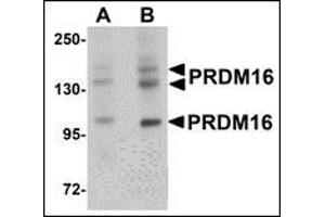 Western blot analysis of PRDM16 in rat brain tissue lysate with AP30689PU-N PRDM16 antibody at (A) 1 and (B) 2 μg/ml. (PRDM16 抗体  (C-Term))