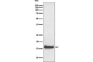Western blot analysis of TTR expression in human serum lysate.