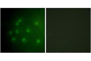 Immunofluorescence analysis of COS7 cells, using Retinoblastoma (Phospho-Thr826) Antibody. (Retinoblastoma Protein (Rb) 抗体  (pThr826))