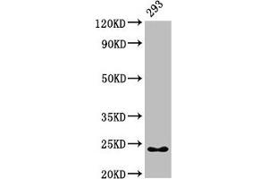 Western Blot Positive WB detected in: 293 whole cell lysate All lanes: HMGB3 antibody at 7 μg/mL Secondary Goat polyclonal to rabbit IgG at 1/50000 dilution Predicted band size: 23 kDa Observed band size: 23 kDa