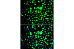 Immunofluorescence analysis of A549 cell using ZBTB25 antibody. (ZBTB25 抗体)