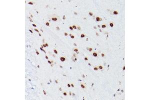 Immunohistochemistry of paraffin-embedded Mouse spinal cord using NSUN5 antibody ( ABIN7268955) at dilution of 1:100 (40x lens). (NSUN5 抗体  (AA 277-466))