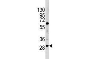 Western blot analysis of LIN28B antibody and HL-60 lysate (LIN28B 抗体  (AA 1-30))