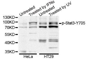 Western blot analysis of extracts of HT-29 cell line, using Phospho-Stat3-Y705 antibody. (STAT3 抗体  (pTyr705))