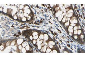 ABIN6272628 at 1/100 staining Rat colon tissue by IHC-P. (ADAM8 抗体  (Internal Region))