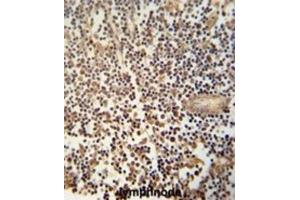 Immunohistochemistry (IHC) image for anti-DNA Segment, MCA1, Multiple CA Repeat 1 (MCA1) antibody (ABIN3002773) (MCA1 抗体)