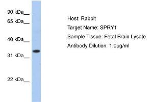 WB Suggested Anti-SPRY1 Antibody Titration:  0. (SPRY1 抗体  (N-Term))