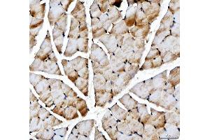 IHC analysis of ACSS2 using anti-ACSS2 antibody (ABIN7600569).