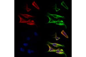 ABIN6259847 and ABIN6277044 staining Hela cells by IF/ICC.