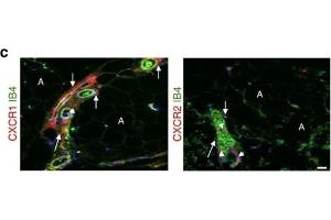 Immunofluorescence (Paraffin-embedded Sections) (IF (p)) image for anti-Chemokine (C-X-C Motif) Receptor 1 (CXCR1) (C-Term) antibody (ABIN2854740)