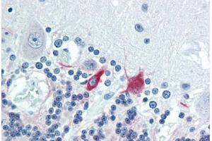 Immunohistochemistry (Paraffin-embedded Sections) (IHC (p)) image for anti-Microtubule-Associated Protein 2 (MAP2) antibody (ABIN462127)