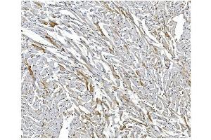 IHC analysis of ARF6 using anti-ARF6 antibody (ABIN4886473). (ARF6 抗体  (AA 2-175))