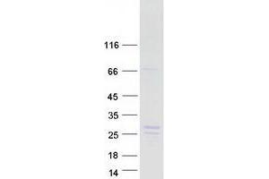 Validation with Western Blot (NBL1 Protein (Transcript Variant 2) (Myc-DYKDDDDK Tag))