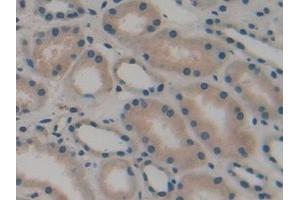 Detection of ATP1b3 in Human Kidney Tissue using Polyclonal Antibody to Sodium/potassium Transporting ATPase Subunit Beta-3 (ATP1b3)