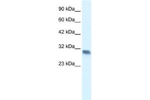 WB Suggested Anti-FHL2 Antibody Titration:  0. (FHL2 抗体  (C-Term))