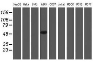 Image no. 10 for anti-NADH Dehydrogenase (Ubiquinone) Complex I, Assembly Factor 7 (NDUFAF7) antibody (ABIN1499667) (NDUFAF7 抗体)