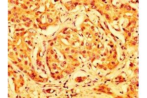Immunohistochemistry (IHC) image for anti-ATP-Binding Cassette, Sub-Family G (WHITE), Member 5 (ABCG5) (AA 1-127) antibody (ABIN7144938)
