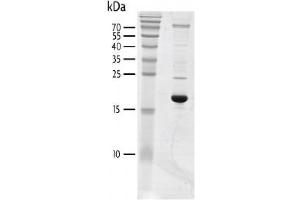 Recombinant BRD3 (24-144) protein gel. (BRD3 Protein (AA 24-144) (His tag,DYKDDDDK Tag))