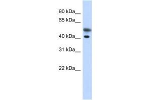 Tropomodulin 2 antibody used at 1 ug/ml to detect target protein. (TMOD2 抗体)