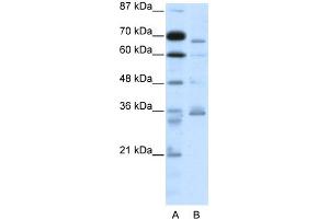 WB Suggested Anti-PCSK6 Antibody Titration:  2. (PCSK6 抗体  (N-Term))