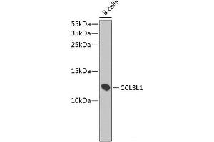 Western blot analysis of extracts of B-cell cells using CCL3L1 Polyclonal Antibody at dilution of 1:1000.