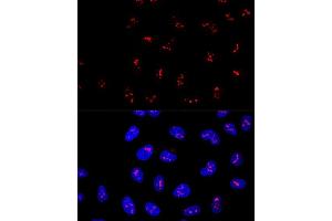 Immunofluorescence (IF) image for anti-KRR1, Small Subunit (SSU) Processome Component, Homolog (KRR1) (AA 1-381) antibody (ABIN1680621)